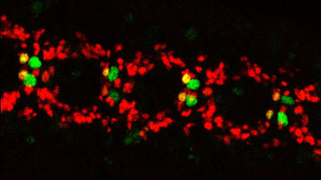 Expression of Hey in 'A' type (vMP2) neurons